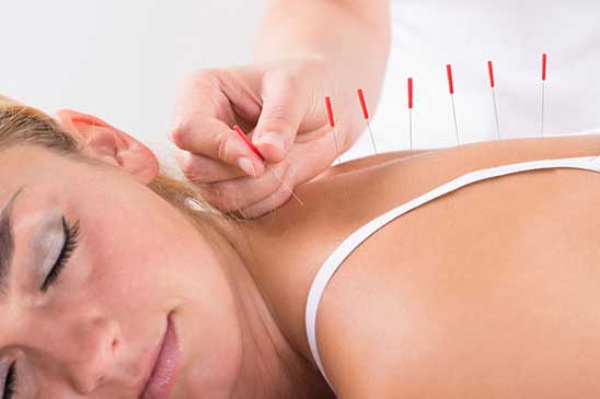 Kuru İğneleme & Akupunktur